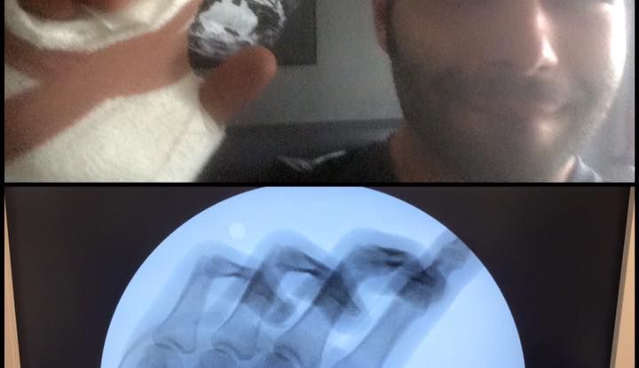 Danilo Petrucci operato a Melbourne, GP del Qatar in forse - Foto 6 di 12